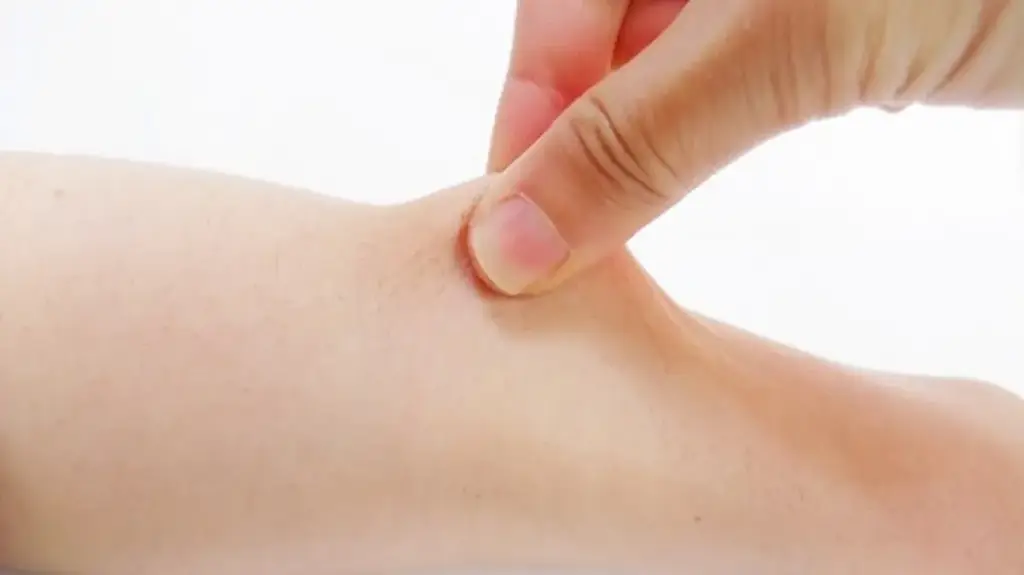 Fingers gently pinching the skin of an arm to show its elasticity
