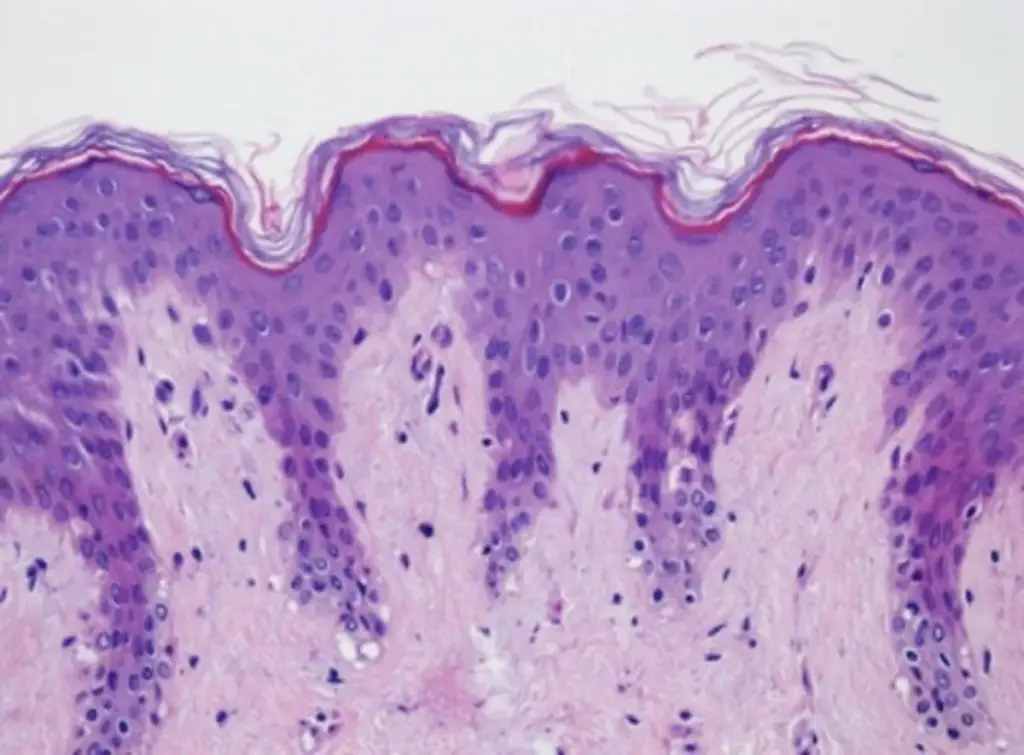 Microscope view of a stained skin section showing epidermis and dermis